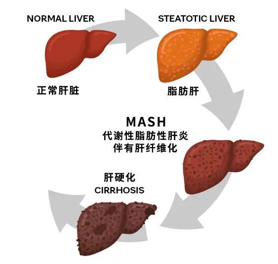 下午5点后不吃饭，可改善脂肪肝，北大团队证实，肠道细菌在其中发挥关键作用！